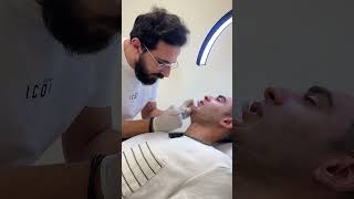 تجربتي مع تعريض الفك ( تكساس ) و ال jawline