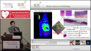 Ryo Torii - In Vivo Measurement of Flow Dynamics and Aortic Wall Shear Stress