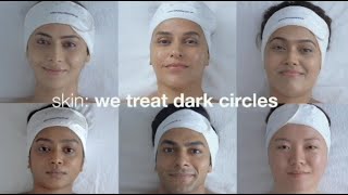 How to treat face dark circles #how to clean face acne how to remove face pimples warts #mrnajeebide