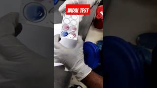 Widal Test 🩸#viralvideo #youtubeshorts #medical #youtube #lab #youtube #shorts #pathology #dmlt#mbbs