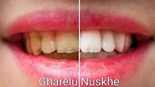 आज ही अपनाएं ये टिप्स | मिंटो में चमक जाएंगे दांत | Teeth True information | in hindi /Urdu