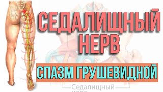 Спазм грушевидной. Защемление седалищного нерва || Боль в пояснице