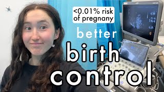 The birth control method no one talks about | Everything you need to know about the Gynefix