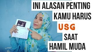 Alasan Penting Kenapa Harus USG Saat Hamil Muda