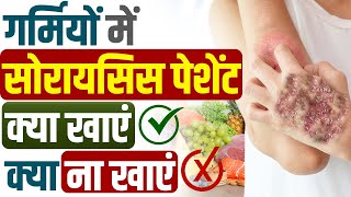 Psoriasis Patient Garmiyon Mein Kya khayen Kya Na khayen ? | सोरायसिस पेशेंट गर्मियों में क्या खाएं