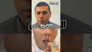 الفرق بين الدعامة الحديثة و الفتيل القديم   #مركز_جراحات_الشخير_د_هشام_ابراهيم