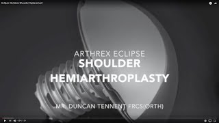 Eclipse Stemless Shoulder Replacement