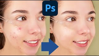 Photoshop Hacks: Removing Pimples in Just 60 Seconds: Photoshop Tips and Tricks for a Smooth Finish