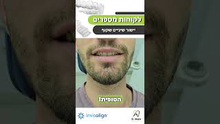 יישור שיניים שקוף אינויזליין invisalign המקורי