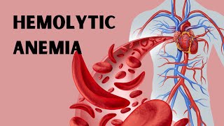 Hemolytic Anemia: Understand, Don't Memorise!