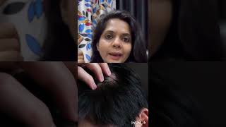 Main types of Alopecia| what type of alopecia u have| hairloss types in Hindi #shorts