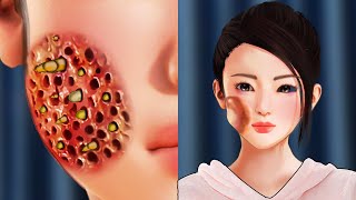 [ASMR] Cavities treatment animation Removal Makeover! a pale-skinned girl into a model/BEAUTY MAKEUP