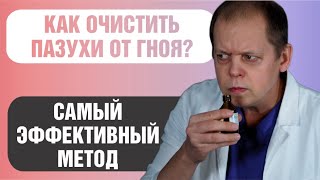 Как лечить гайморит без прокола и очистить пазухи носа?