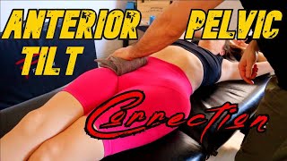 How to Correct Anterior Pelvic Tilt with Osteopathic Techniques and Myofascial Massage.