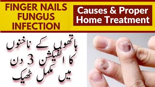 Worst Finger Nail Fungus Infection Home Treatment | Cure Fingernail Fungus Fast | Healthcare Remedy