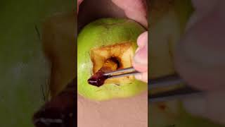 KATTY SAVED AN APPLE...AND ATE IT😁😉😜#shorts #tiktok #surgery