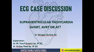 SVT. AVRT, AVNRT or ATRIAL TACHYCARDIA?