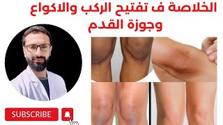 الطريقة الوحيدة و الصحيحة تبييض الركب و الاكواع و جوزة القدم