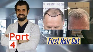 Part 4: Cinik Clinic: Turkey: Hair Transplant: First Haircut