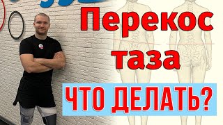 Перекос таза. Сколиоз. Как исправить и что делать?