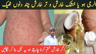 Kharish Ka ilaj | Kharish Khatam Karne Ka Tarika | Scabies Ka Permanent ilaj Dr Mushtaq Ahmad