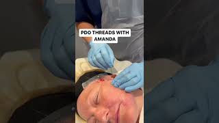 THREAD LIFT WITH AMANDA - Subscribe below