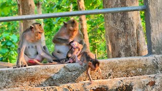 Poor Baby Is Suspected By Mother To Have Eye Problems, Mother Checks Of Baby