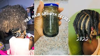 Visible Results in 7 days / Use This Twice a Week for Massive Hair Growth | Grow Long & Thick Hair