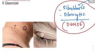 KROK 1 | pathomorphology MCQ explanations | part 3