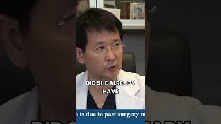 🔍 Fixing Botched Surgeries: A Surgeon's Perspective 🔍 #shorts