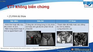 HÌNH ẢNH HỌC VIÊM TÚI THỪA ĐẠI TRÀNG | BSCKII. Bùi Khắc Vũ