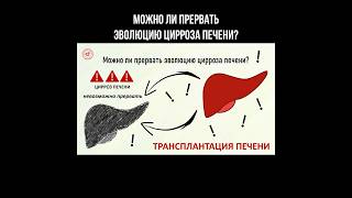 Можно ли прервать эволюцию цирроза печени? #циррозпечени #цирроз #печень #трансплантация