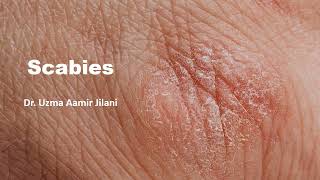 WHAT IS SCABIES | MBBS REVISION GUIDE | 2024 SHORT GUIDE