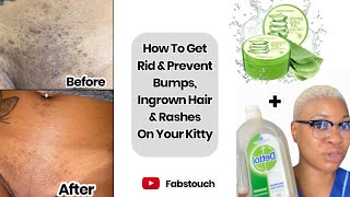 Affordable Way to Get Rid & Prevent Pimples,Ingrown Hair,Shaving Bumps,Rashes,Boil On Your Privates