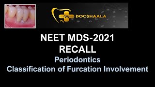 NEET MDS Recall 2021- Classification of Furcation Involvement-Periodontics