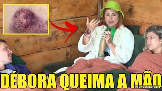 Débora QUElMA a mão e sente dor insuportável - A Produção da fazenda entra em ação