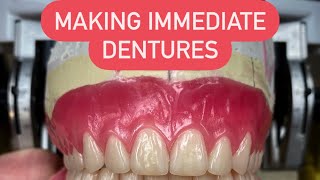 HOW TO MAKE AN IMMEDIATE DENTURES FROM A TO Z #waxbae #immediatedentures #surgicaldentures #dentures