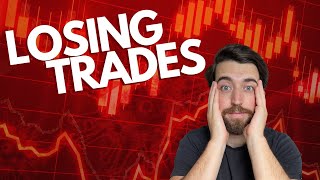 Embracing Loss: The Realities of Day Trading