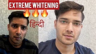 EXTREME Skin Whitening India| skin whitening home remedies| Lighten| Brighten| Skin|tone|hindi|tips