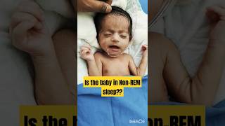 Is the baby in Non-REM sleep?? #youtubeshorts #shorts #shortvideo