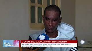 Jovem pede ajuda para tratamento de pele que enfrenta há três anos | Fala CV