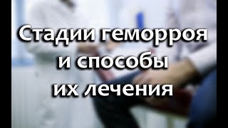 Стадии геморроя (1,2,3,4): фото и их лечение для женщин и мужчин