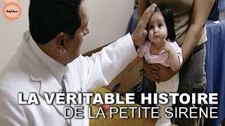 L'Incroyable Histoire du BÉBÉ SIRÈNE : Une Saga Médicale qui A Ému une Nation Entière | Réel·le·s