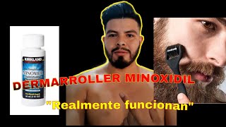 Dermarroller Minoxidil como funciona el dermarroller para crecer la barba funciona?