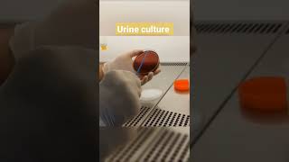 urine culture #shorts