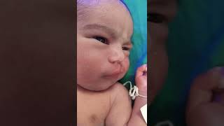 newbornbaby#withabnormalbaby#cuteandbeauyiful#subcribeformorevidoes#