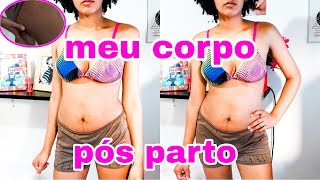 *TUOR PELO MEU CORPO 6 MESES PÓS PARTO CESARIA /COMO ESTÁ HOJE ?*