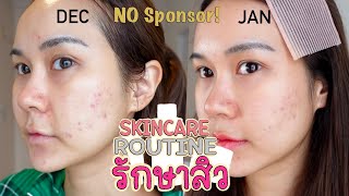 Skincare Routine รักษาสิว เช้า-เย็น No sponsor! หน้าใสขึ้นจนงง | This is Pear