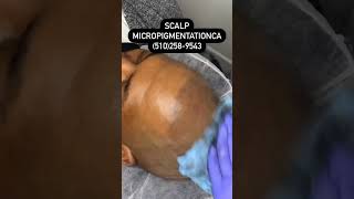 ⁣ScalpMicroPigmentationCA DM for more info .⁣ .⁣ .⁣ .⁣ .⁣ #bald #barber #barbershop