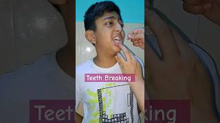 teeth broken #ytshorts #ytviral #shorts